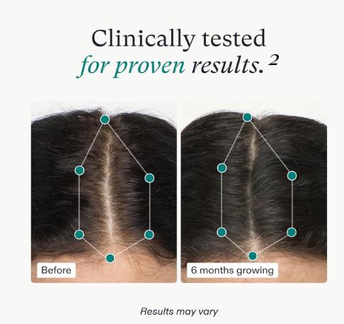 Nutrafol Women's Balance Hair Growth Supplement - 1 Month Supply 120 Capsules .