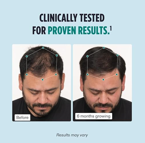 NUTRAFOL Men's Hair Growth Supplement - Pack of 3 for Fuller Hair